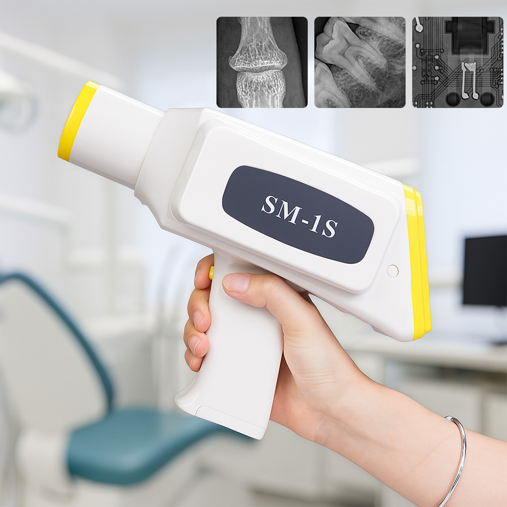 SENTEMEI Digital Portable Dent - Xray Tech Accessories recensione e prezzo