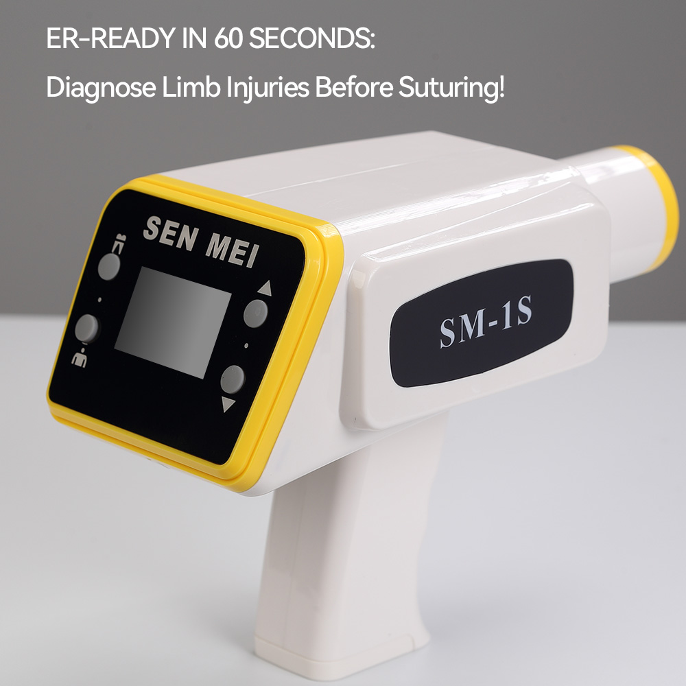 SENTEMEI Digital Portable Dent - Xray Tech Accessories recensione e prezzo